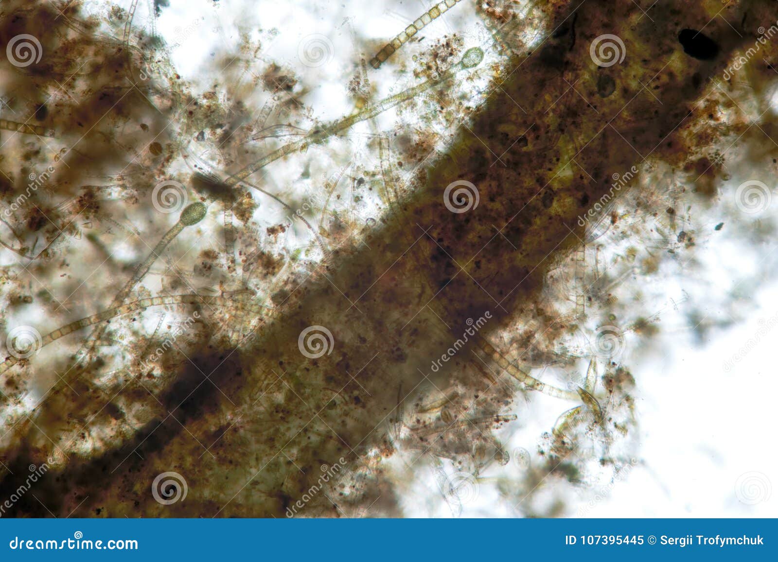 banana-d ciliated organism is protozoa diatom algae exoskeleton by microscope. hornwort or coontails algae fouling with unice