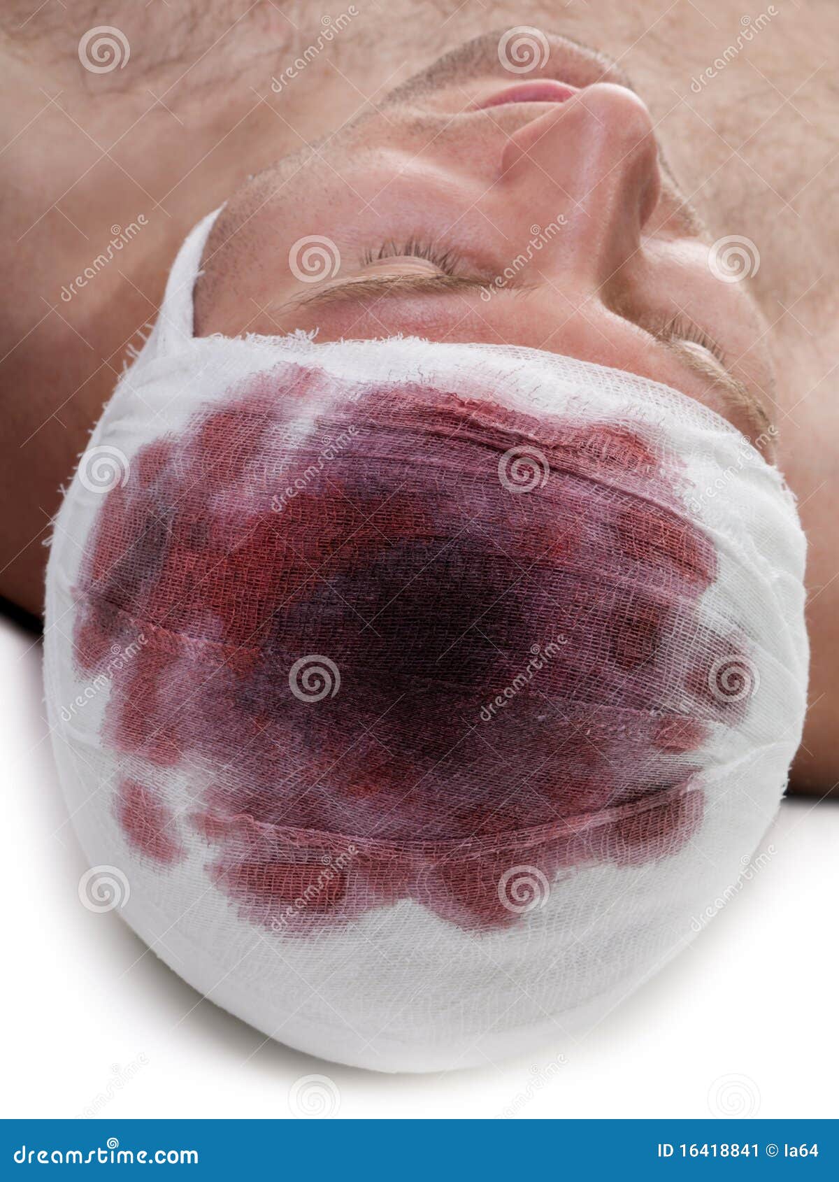 Bandage on Blood Wound Head Stock Image Image of human, contusion