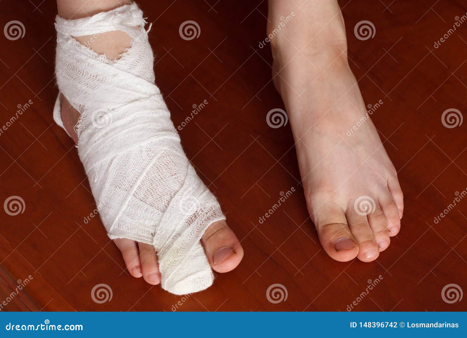Bandage d orteil  photo stock Image du orteil  bandage 