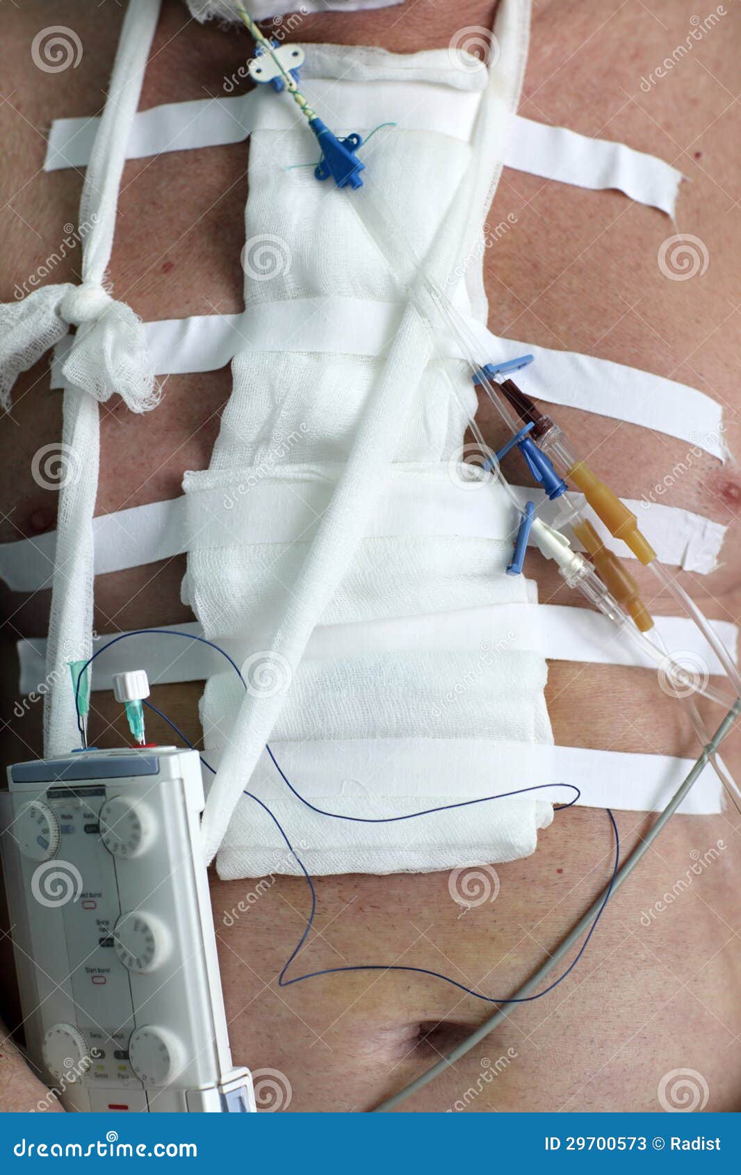 Bandage on chest stock image. Image of nausea, pressure 29700573
