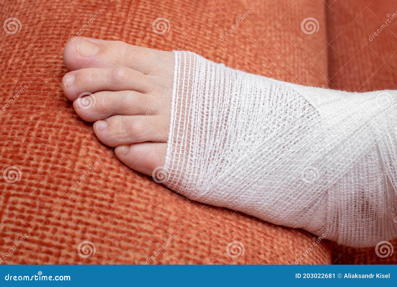 Bandaged Female Leg Wounds At The Wris Pain Medicine Stock Photo bandaged-female-leg-wounds-at-the-wris-pain-medicine-stock-photo