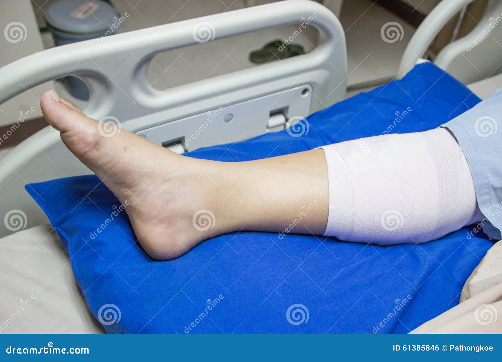 Bandaged Leg on a Hospital Bed. Stock Photo Image of broken, health