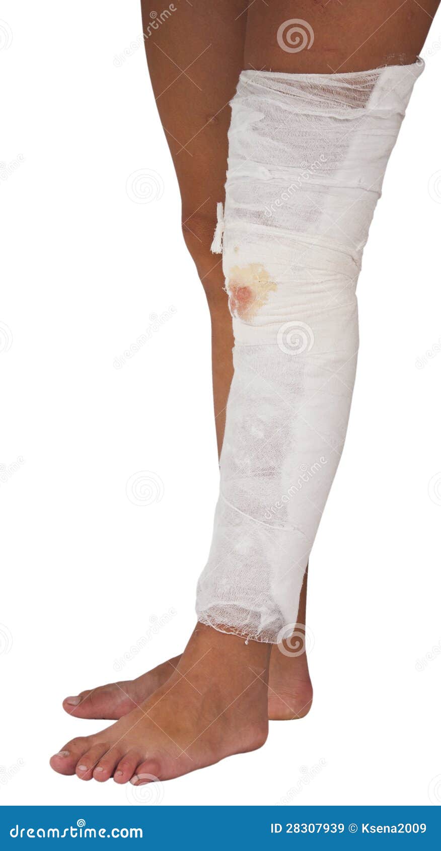 Bandaged wound stock image. Image of bandage, human, muscular 28307939