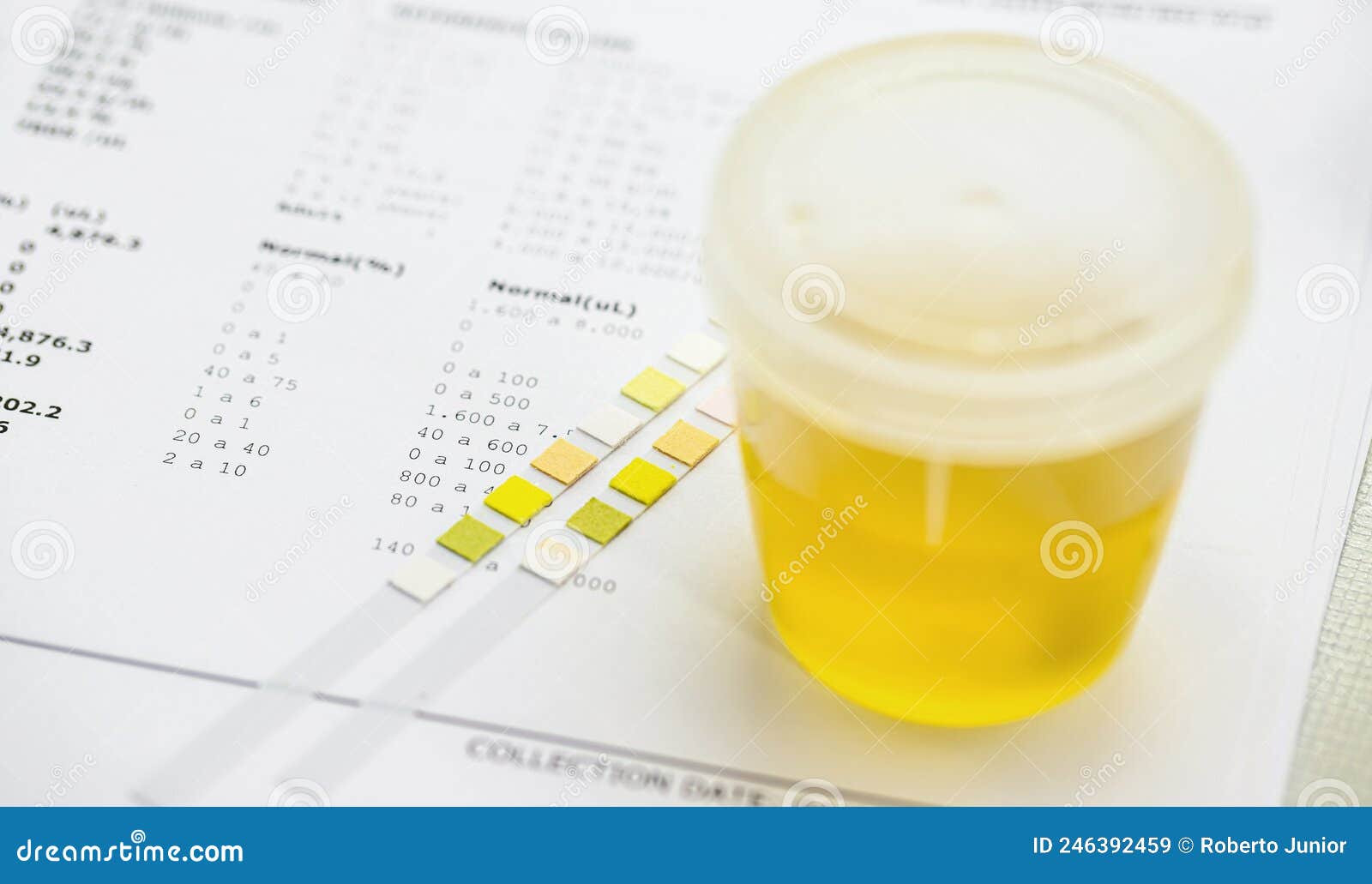 Bande De Réactif Utilisée Pour L'analyse D'urine Avec Un Flacon De Type D'urine  Collecté Comme éléments De Sédiments Anormaux Image stock - Image du  bandes, contrôle: 246392459