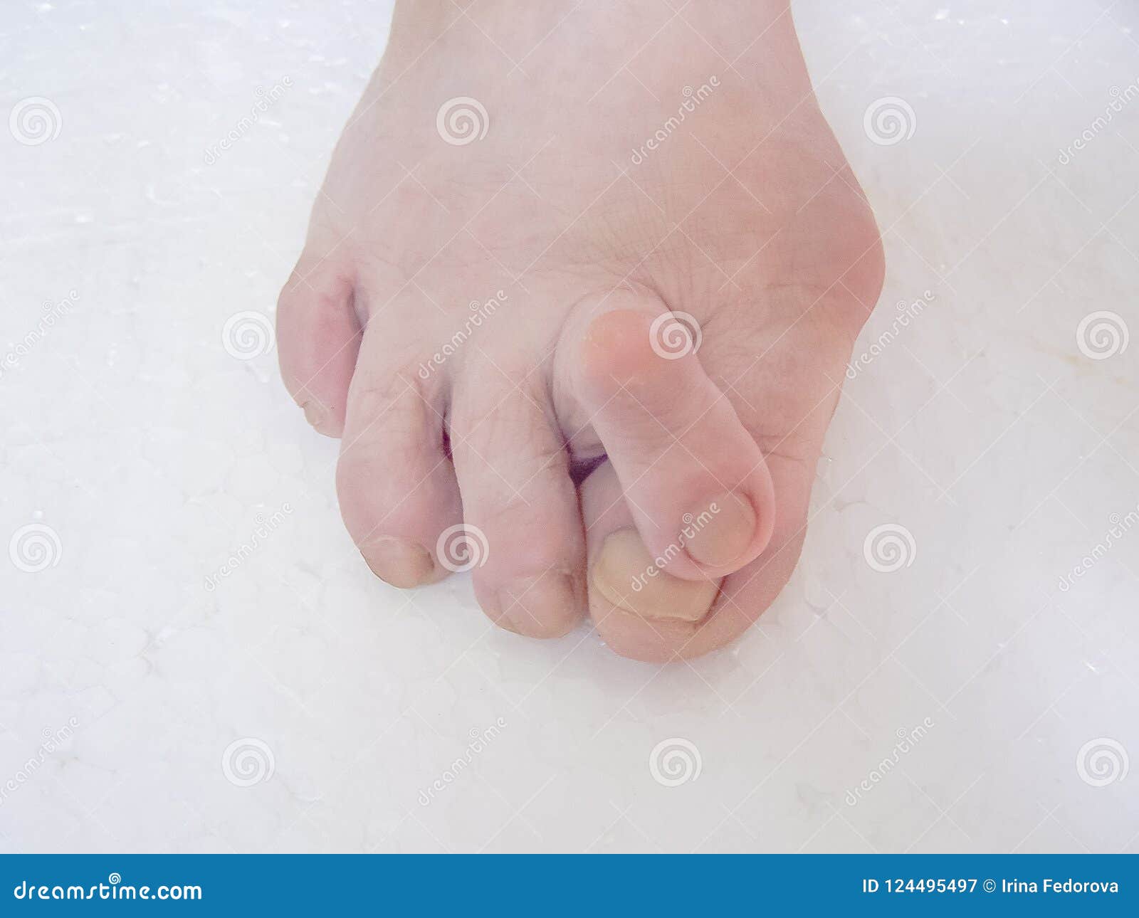 Big Deform Photos Free Royalty Free Stock Photos From Dreamstime