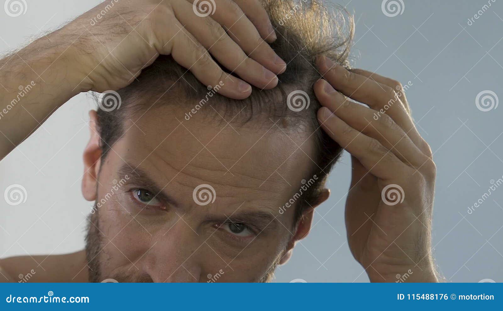 Bearded Man Standing in Front of Mirror and Looking at His Thinning Hair, Bald Stock Footage - Video of forties, front: 115488176 Bearded Man Standing in Front of Mirror and Looking at His Thinning Hair, Bald Stock Footage - Video of forties, front: 115488176