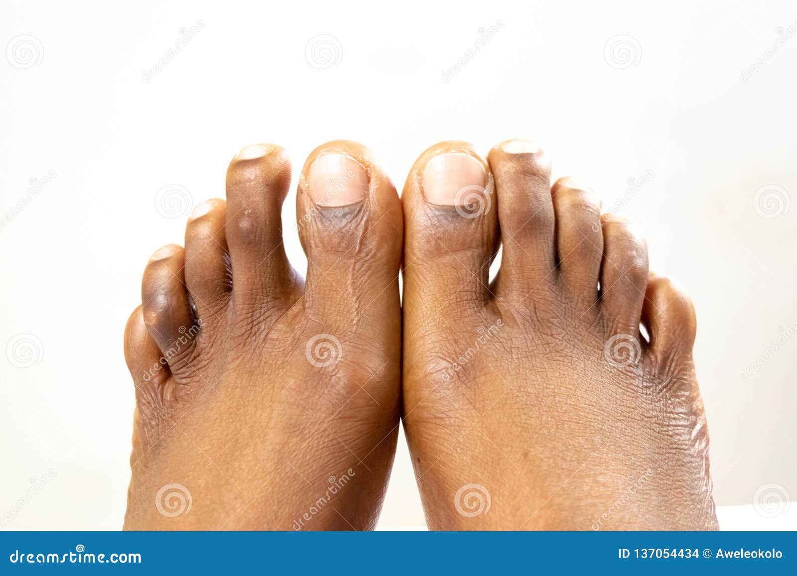 Pretty Black Girl Feet