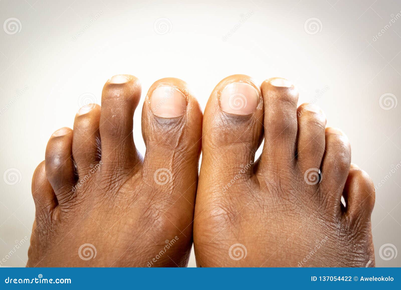 Ebony feet girl