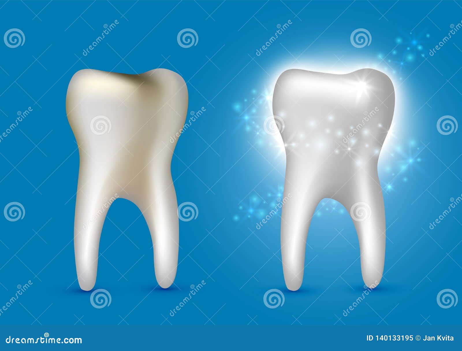 beautiful realistic dentist  set of decayed and white shiny cleansed tooth on blue background