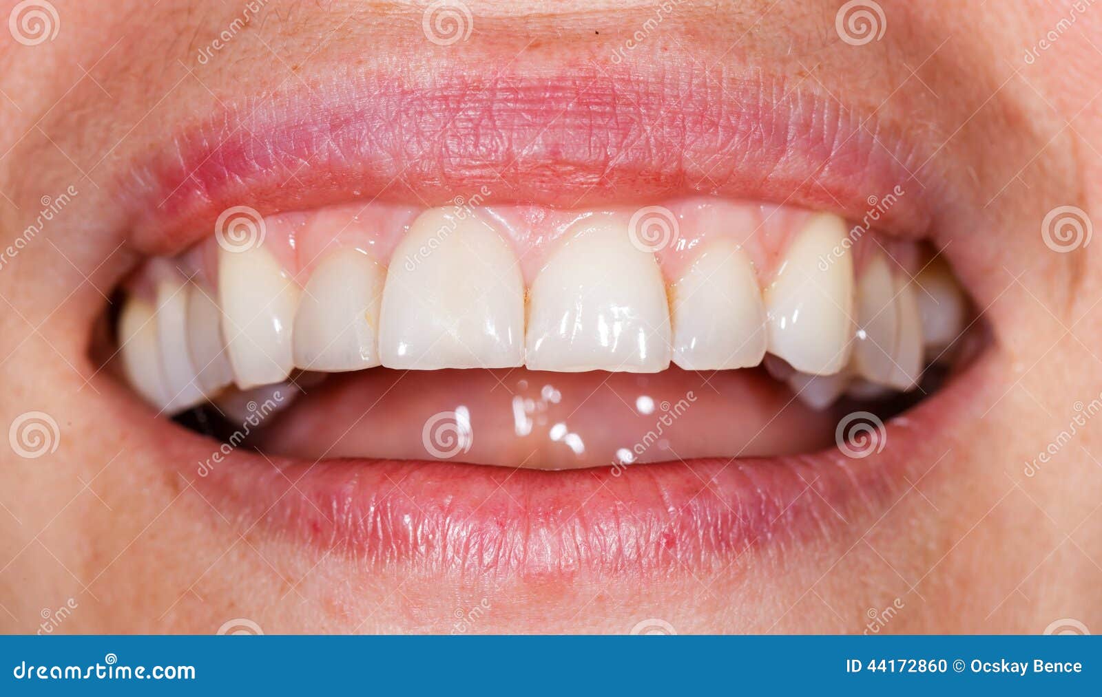 African Woman With White Teeth Smiling And Sticking Tongue 