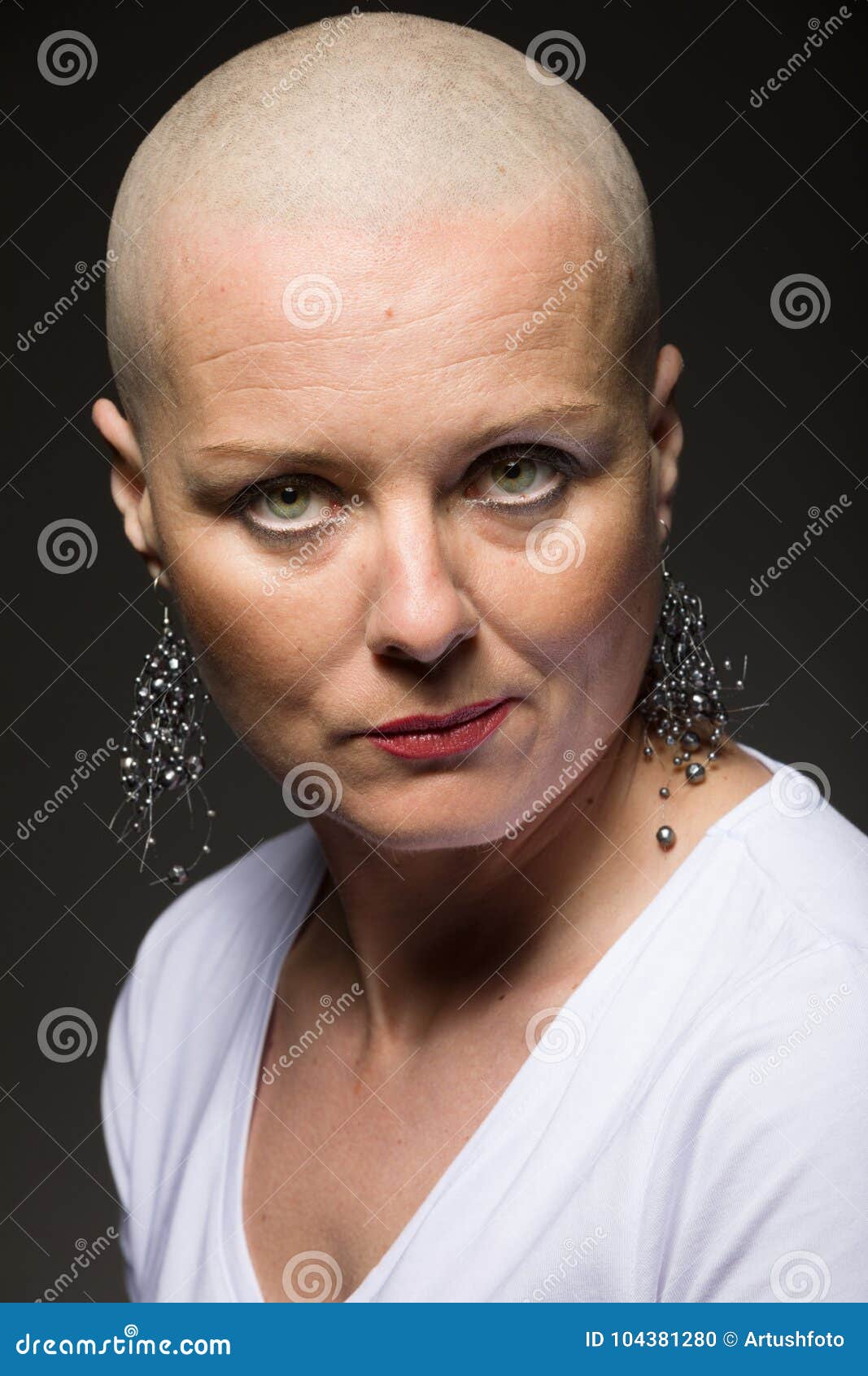 Beautiful Woman Cancer Patient without Hair Stock Photo - Image of cancer, lady: 104381280 Beautiful Woman Cancer Patient without Hair Stock Photo - Image of cancer, lady: 104381280