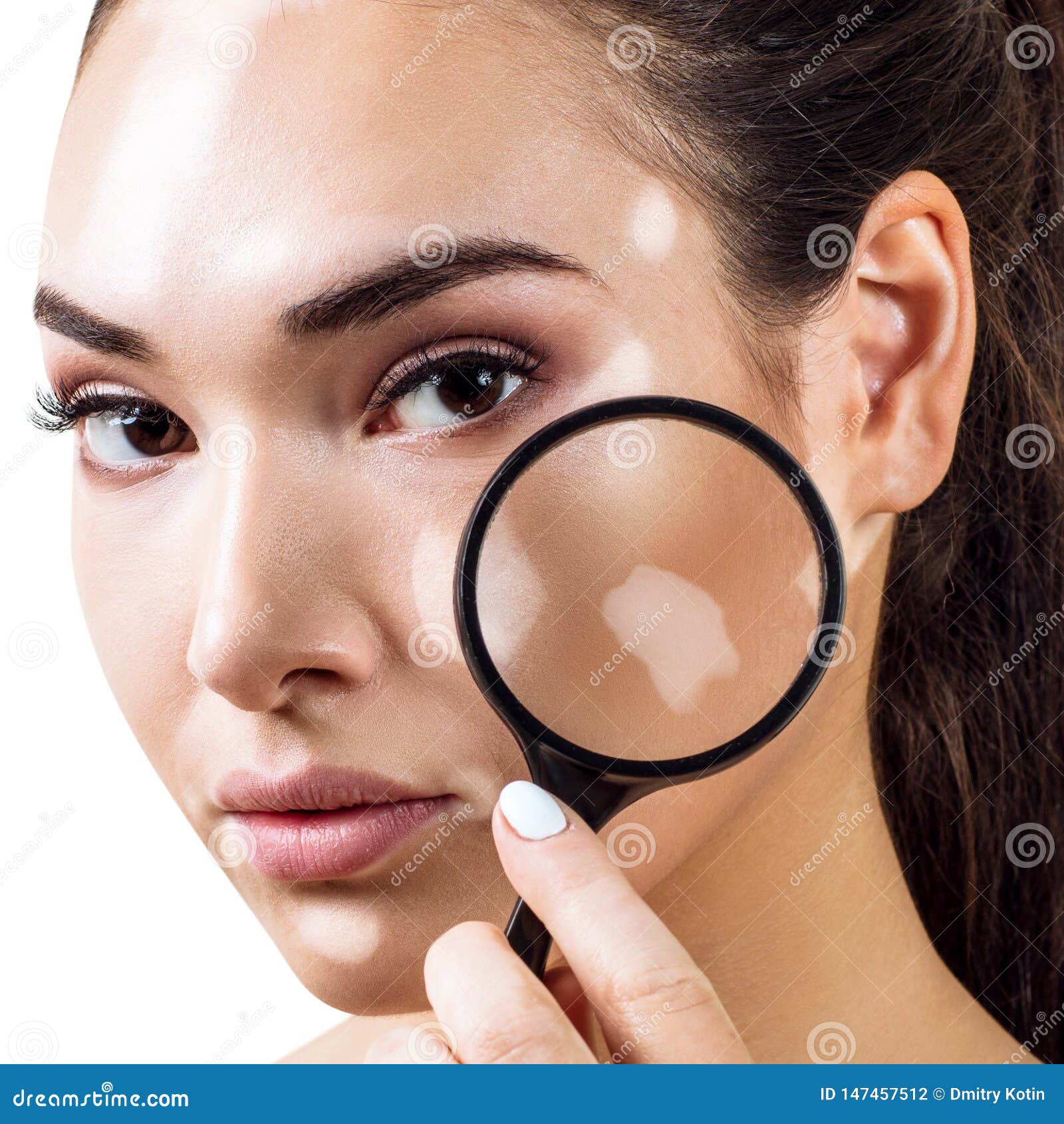 beautiful woman with vitiligo holds magnifying glass.
