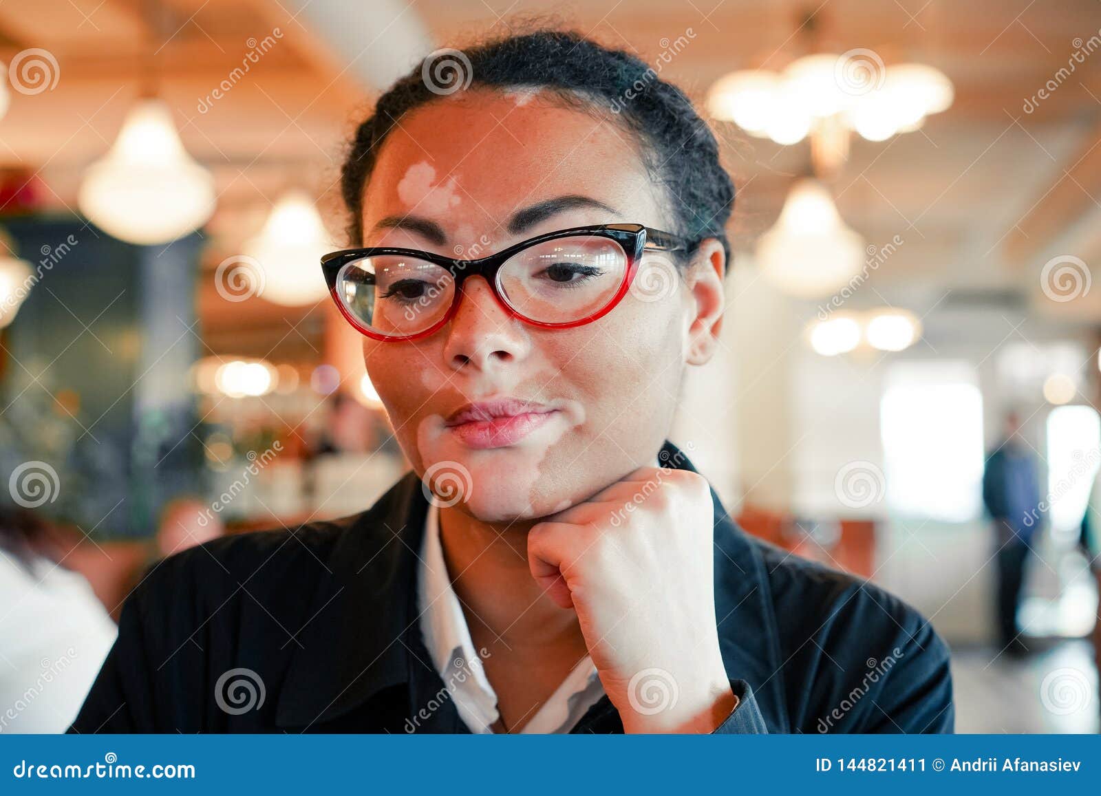 a beautiful young girl of african ethnicity with vitiligo sitting in a restaurant