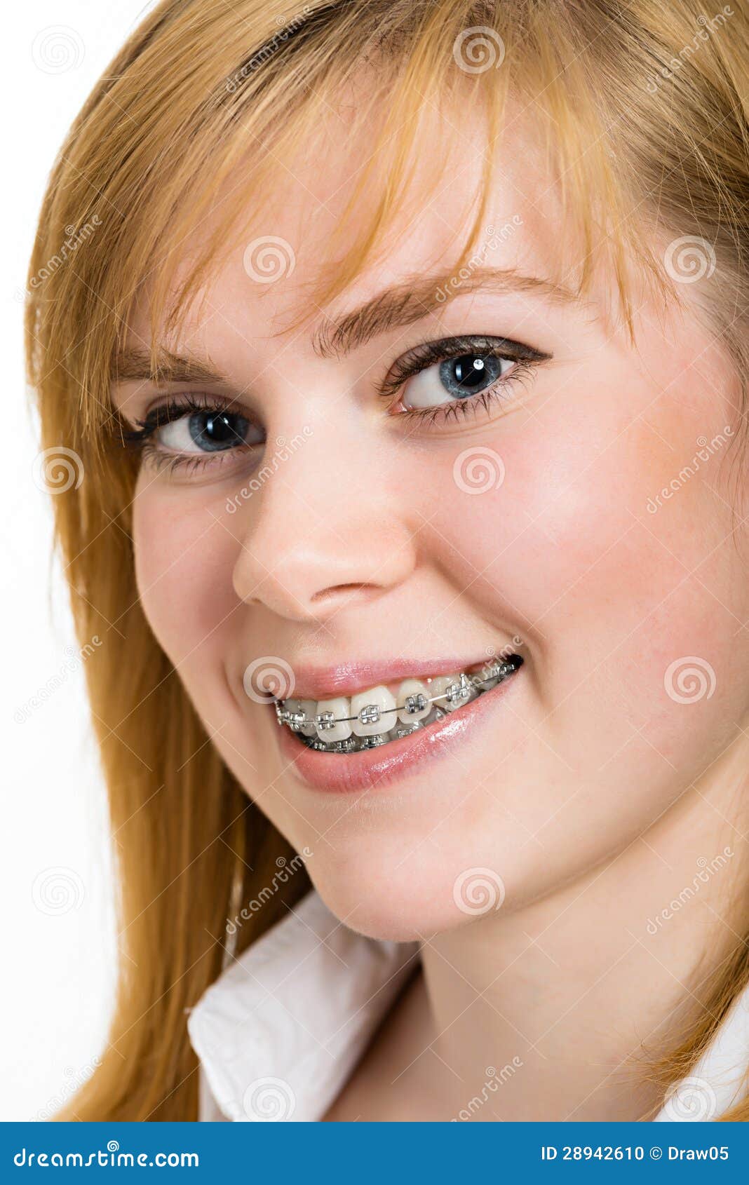 Beautiful Young Woman with Brackets on Teeth Stock Photo - Image of ...