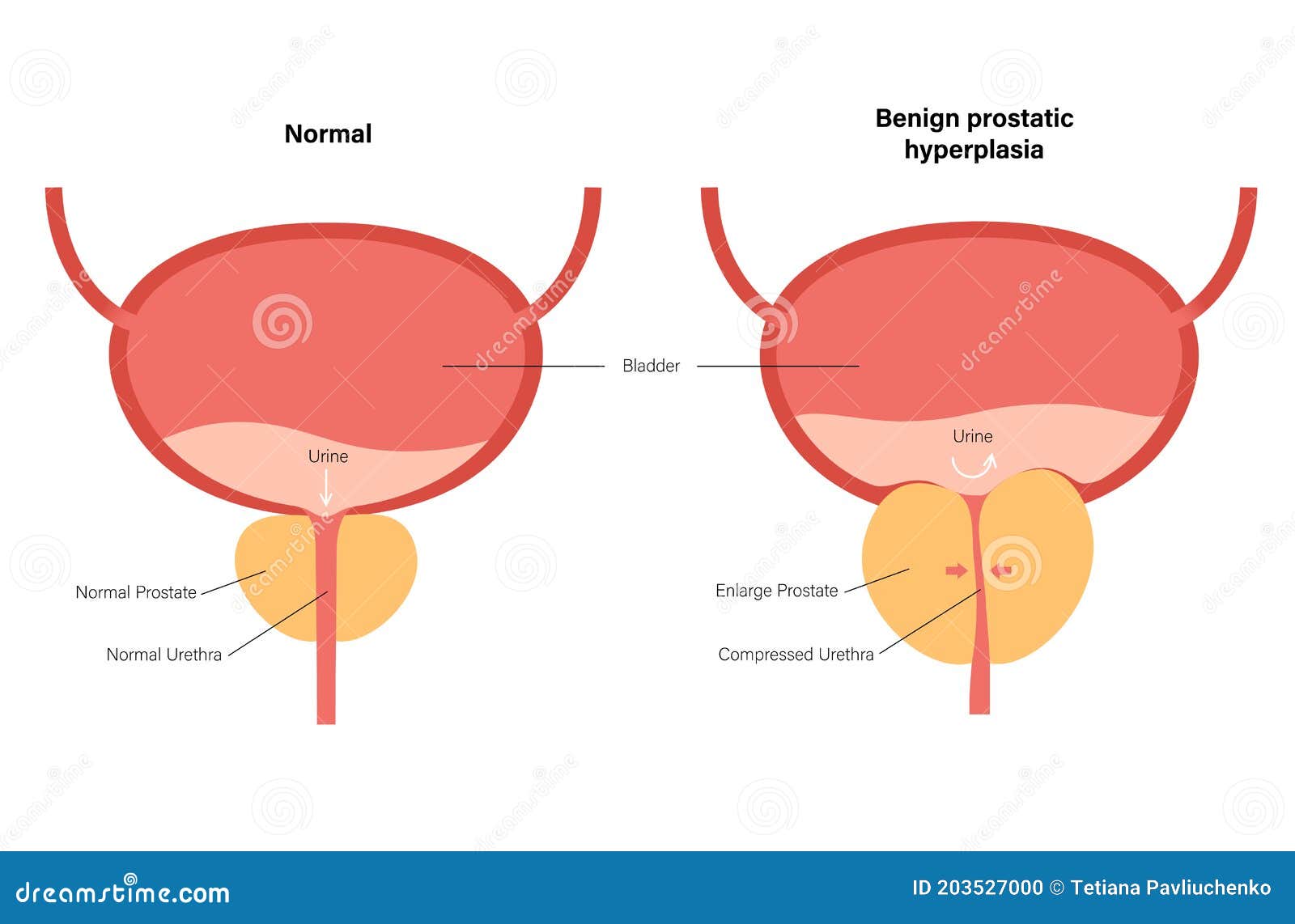 Bph Cartoons Illustrations Vector Stock Images 270 Pictures To bph-cartoons-illustrations-vector-stock-images-270-pictures-to