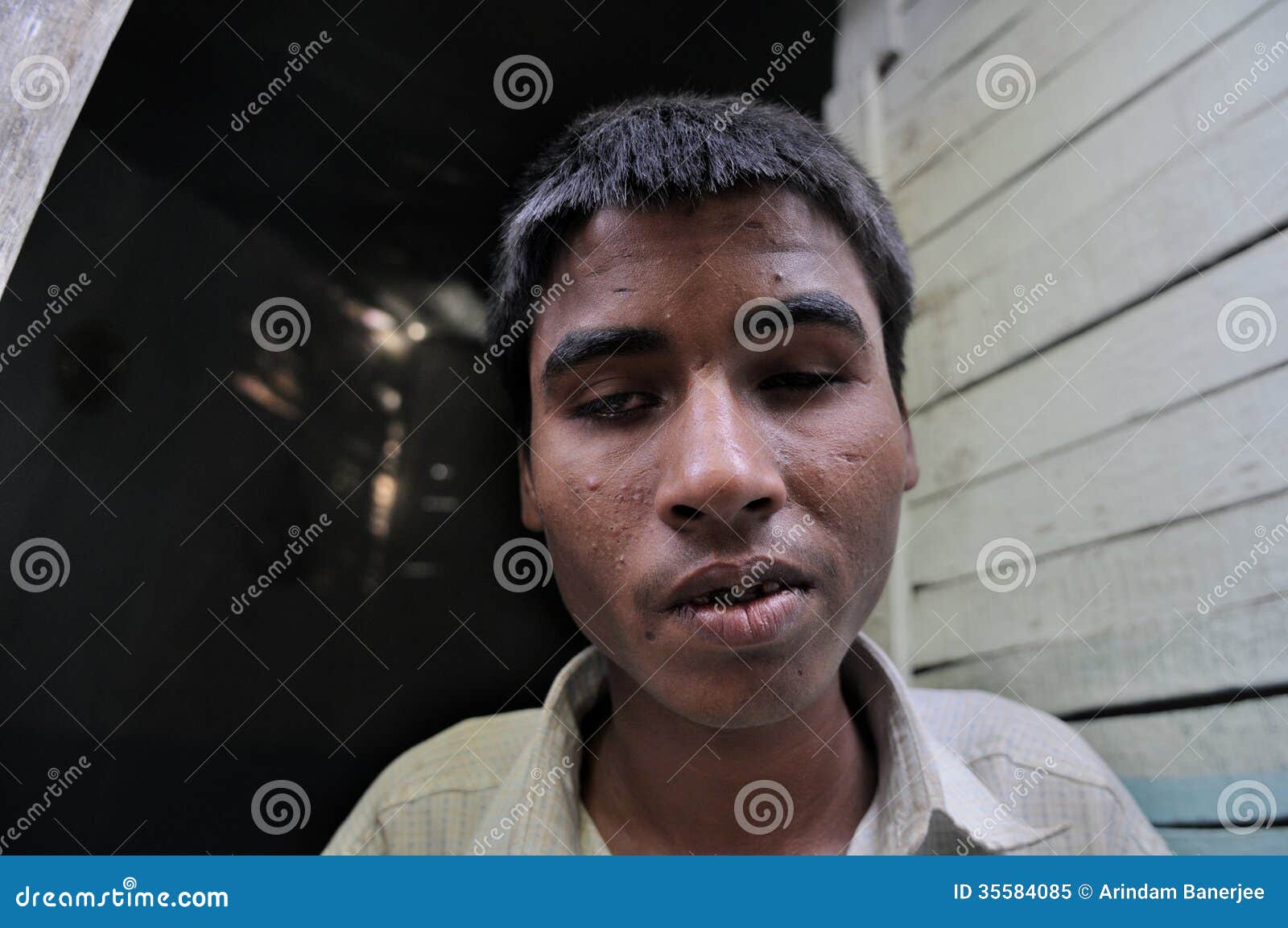 Bhopal imagen editorial. Imagen de desastre, mundo, gente 35584085