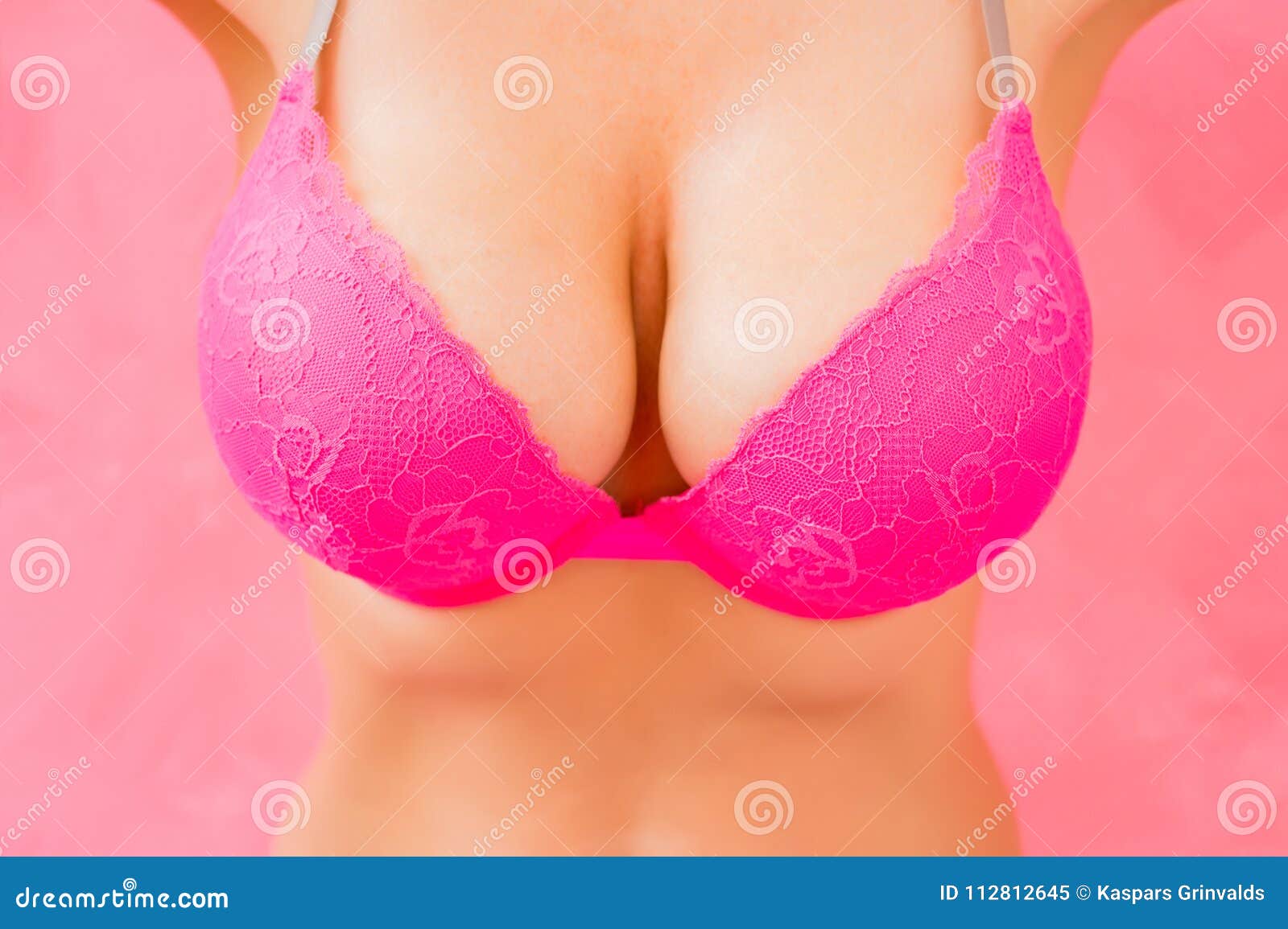 Woman posing in support bra after breast augmentation plastic surgery with  silicone breast implants. Stock Photo