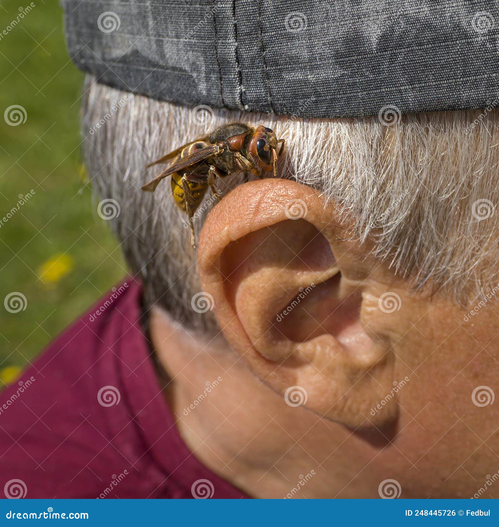 Big on Human Ear before Insect Bite Stock Photo Image of