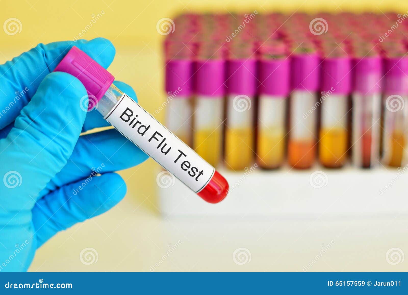 Bird Flu test stock image. Image of analyzing, common 65157559