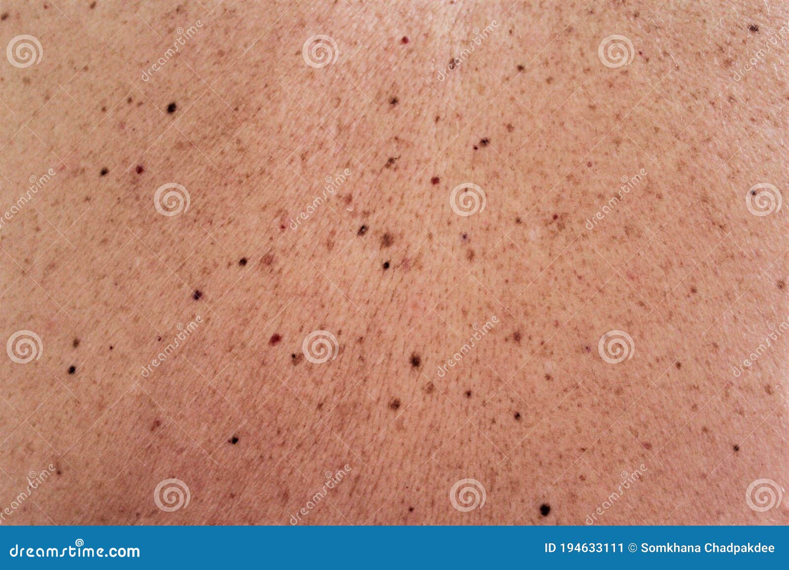 human skin texture stock photo