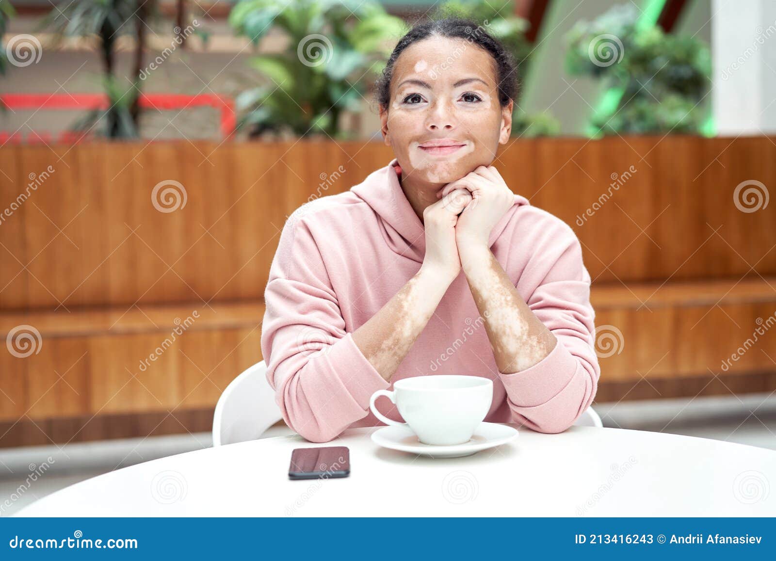 black african american woman with vitiligo pigmentation skin problem indoor dressed pink hoodie