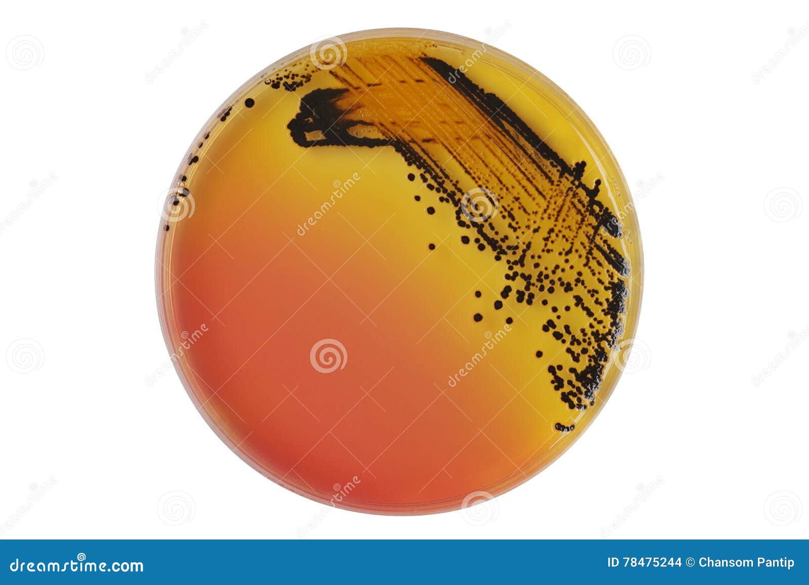 black bacterial colonies of salmonella species on salmonella shigella agar (ss agar, selective and differential medium) plate on