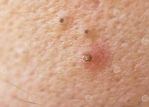 Black Dots Background Stock Photography CartoonDealer 26052260 Black Dots Background Stock Photography CartoonDealer 26052260