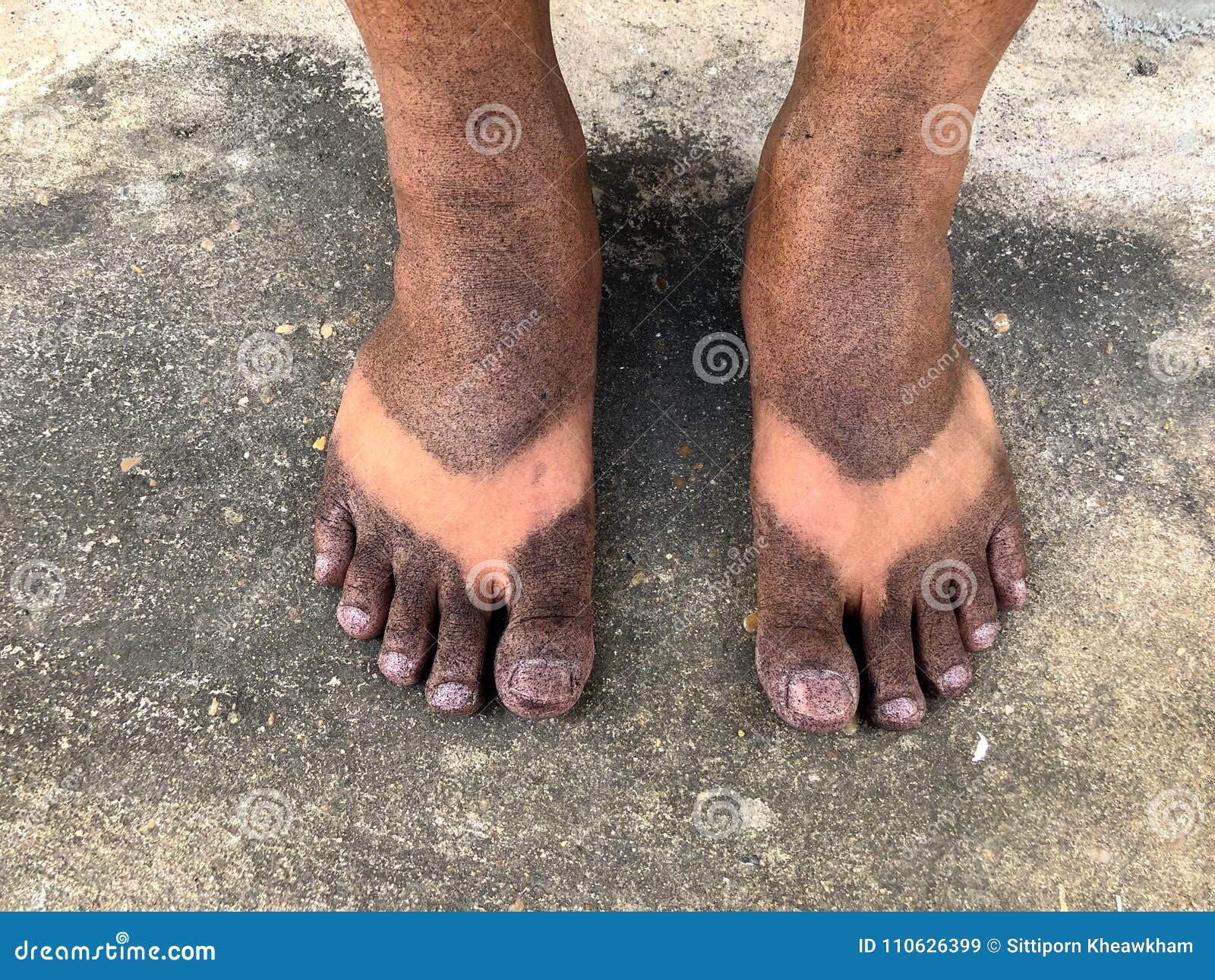 dirty black feet