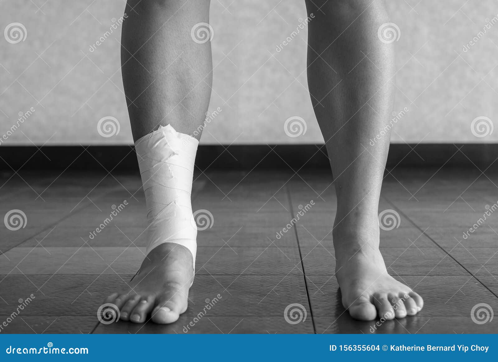 Black and White Version of Ankle Tape Job on an Athleteâ€™s Ankle Stock