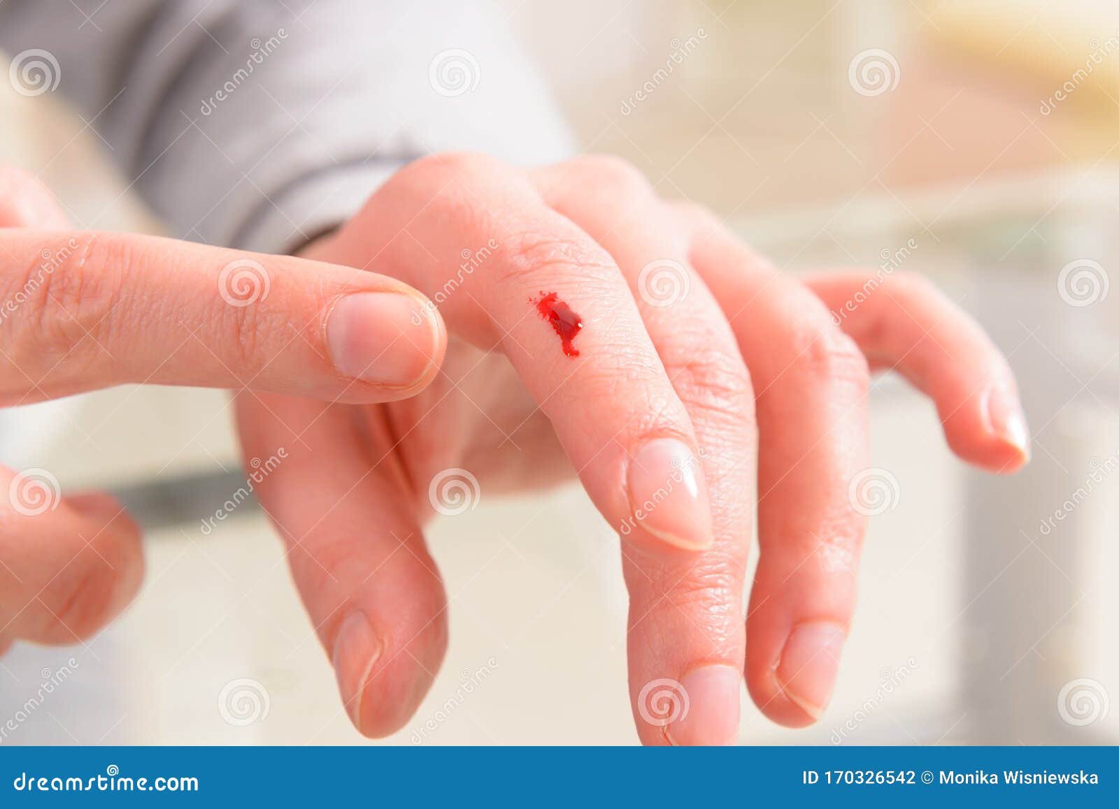 Bleeding Finger Hand With A Wound Stock Photo Image Of Emergency