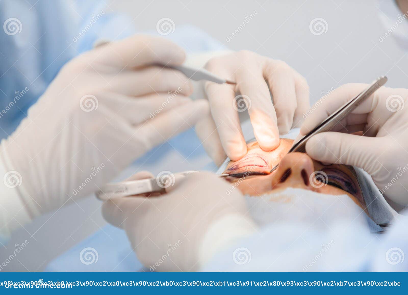 Blepharoplasty, Plastic Surgery Operation for Correcting Defects