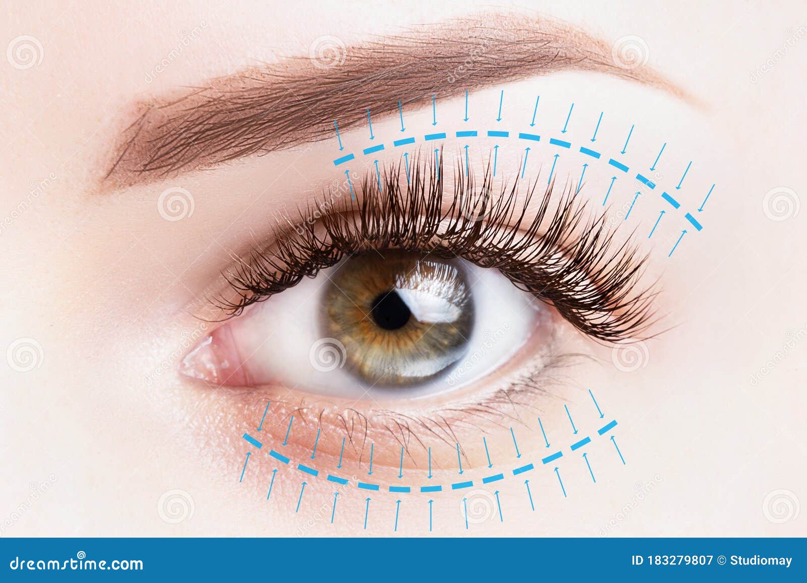 blepharoplasty treatment, plastic surgery, face lift concept. female eye close up