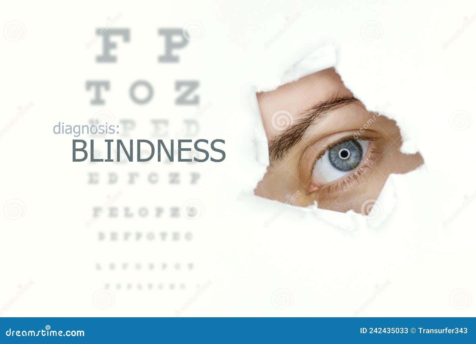 Blindness Disease Poster Wwith Eye Test Chart and Blue Eye on Right