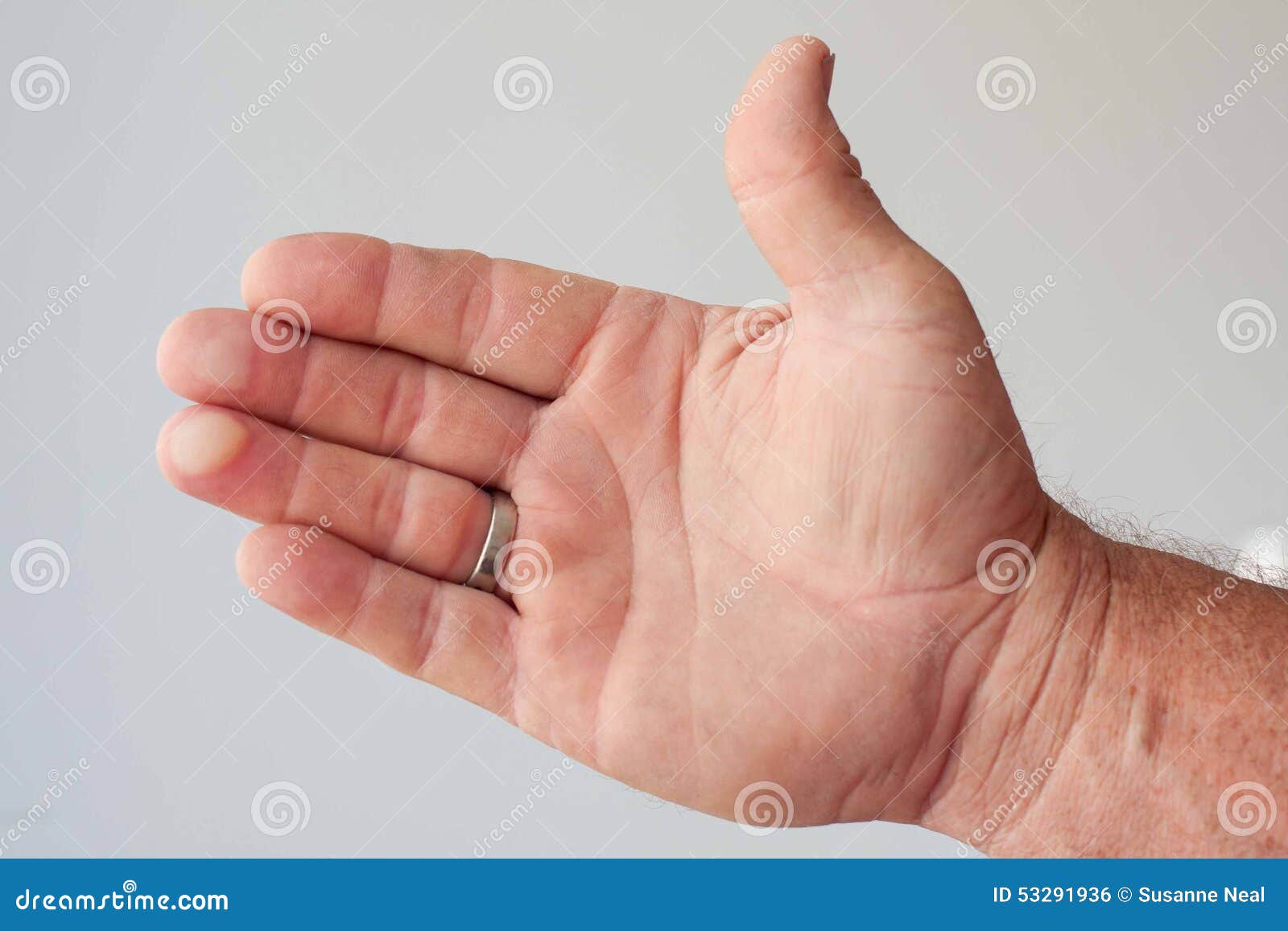 blisters on two fingers of a man's hand