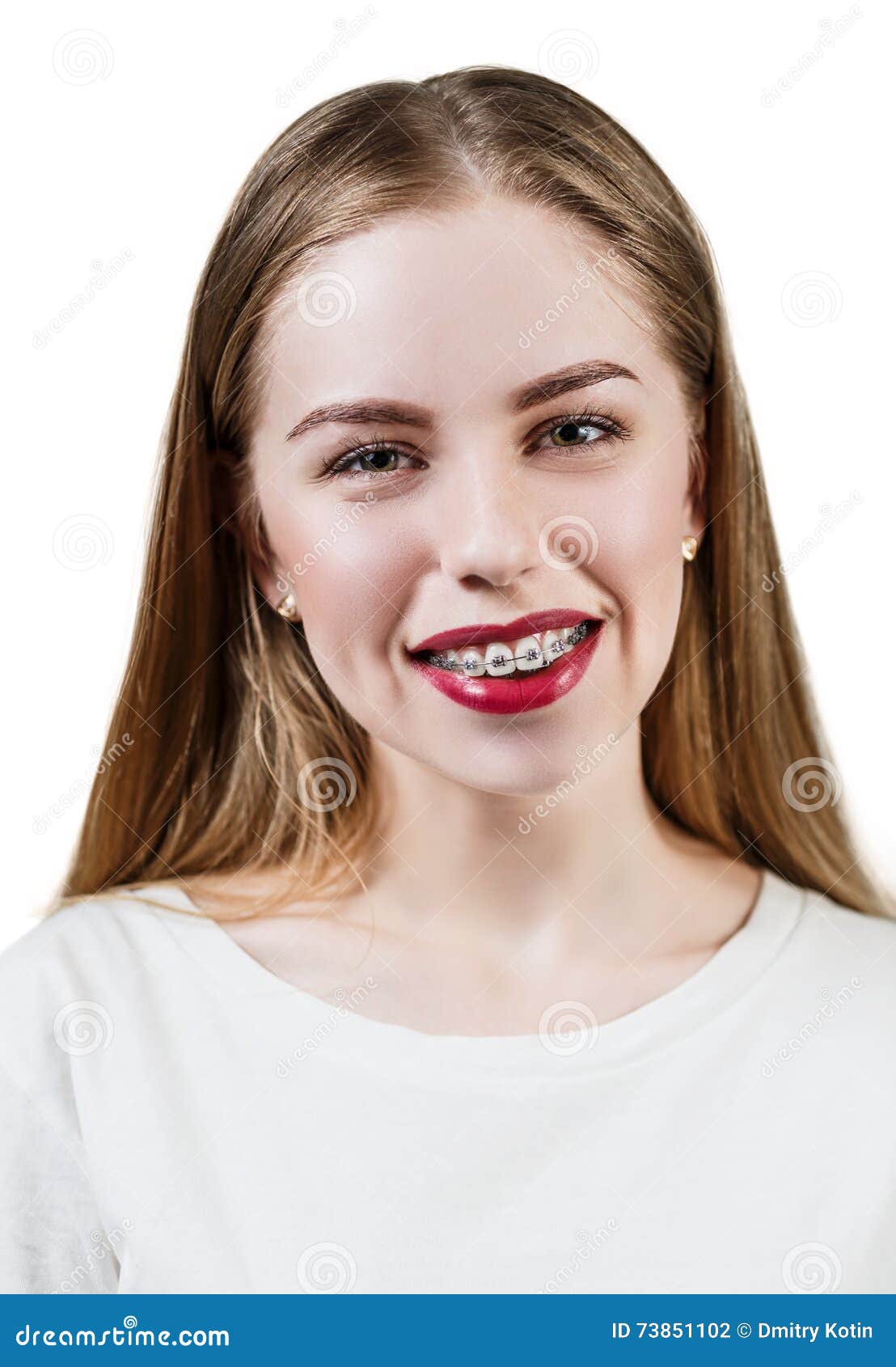 Blond Teenage Girl Wearing Braces Stock Photo - Image of cute ...