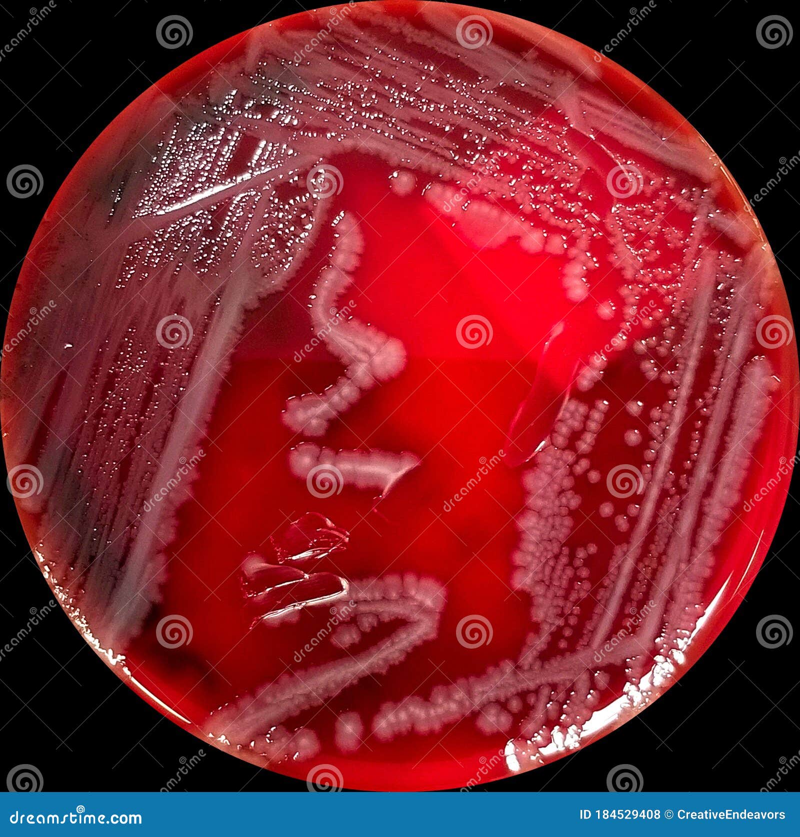 macconkey agar salmonella