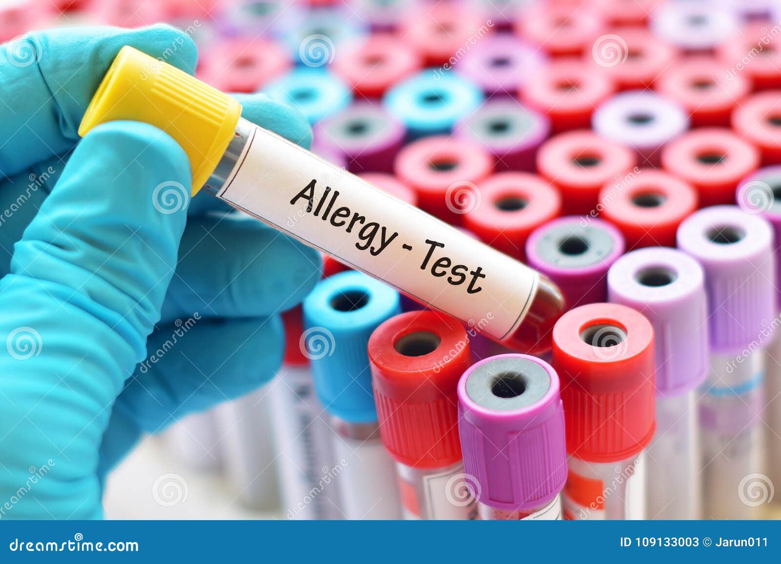 Blood for allergy test stock image. Image of tubes, experiment 109133003