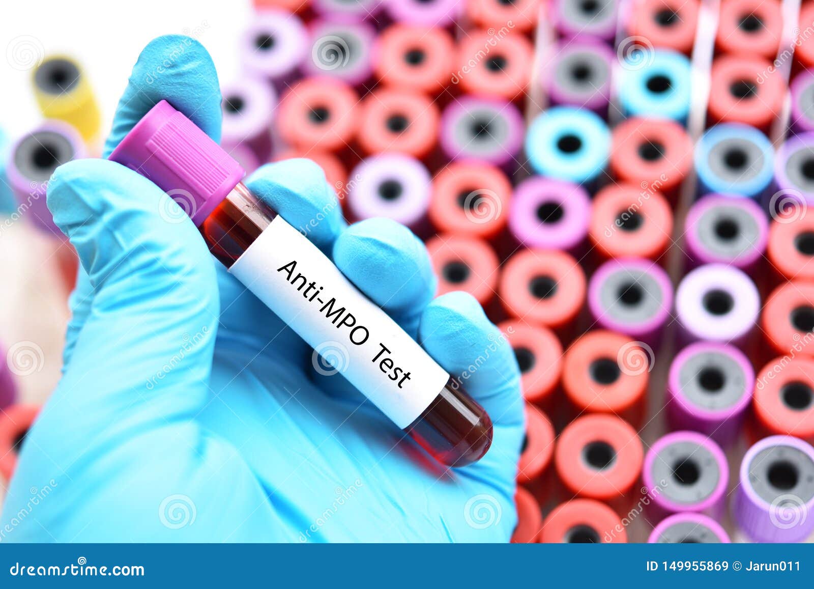 Blood for antiMPO test stock image. Image of protease 149955869