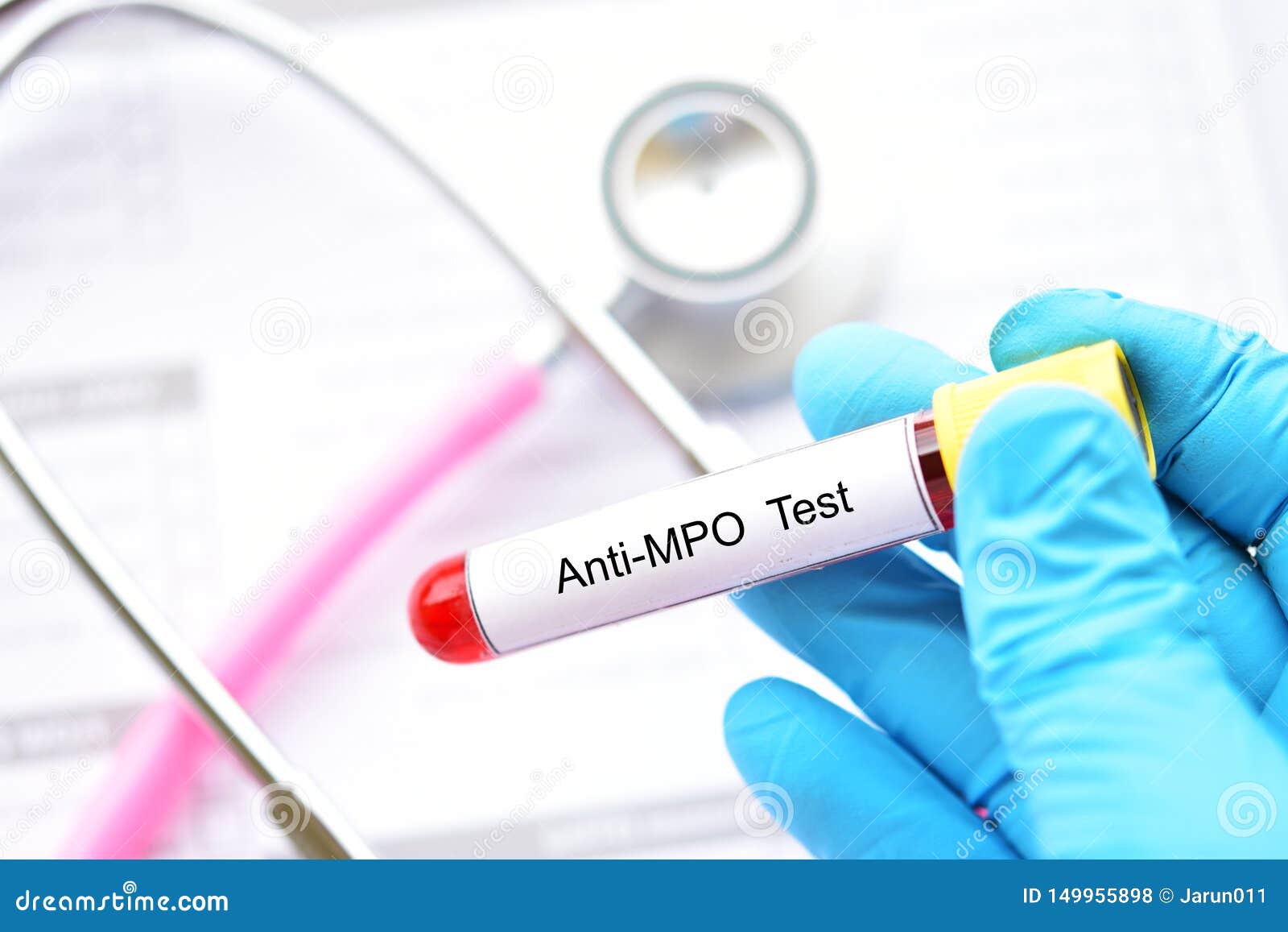 Blood for antiMPO test stock photo. Image of antibodies 149955898
