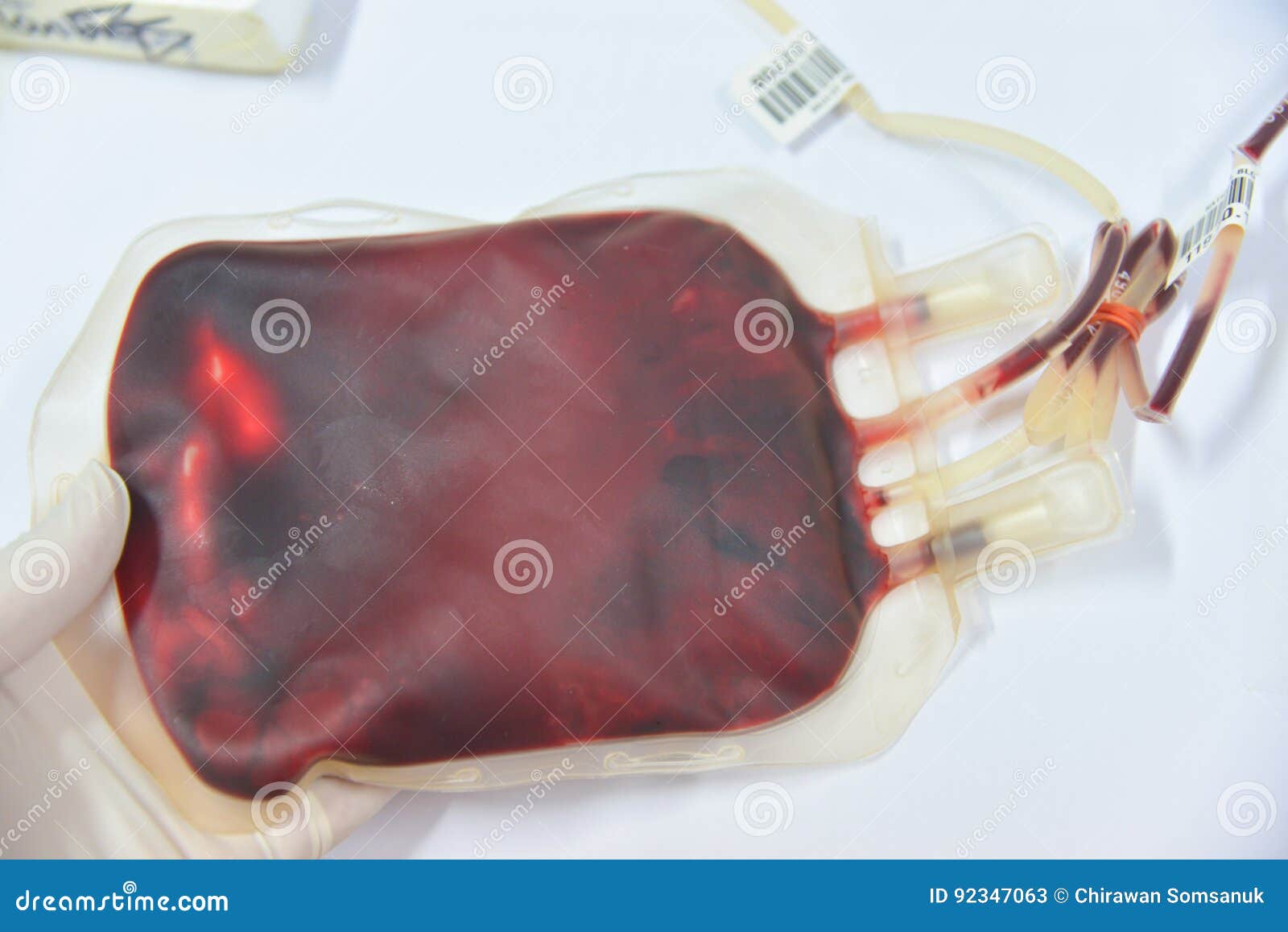 Blood bag in laboratory stock image. Image of clinic 92347063