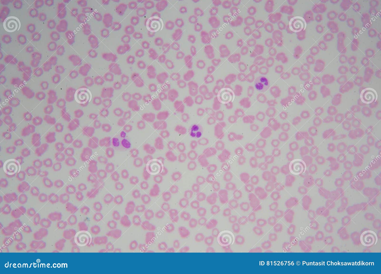 Normal Blood Cells Under Microscope