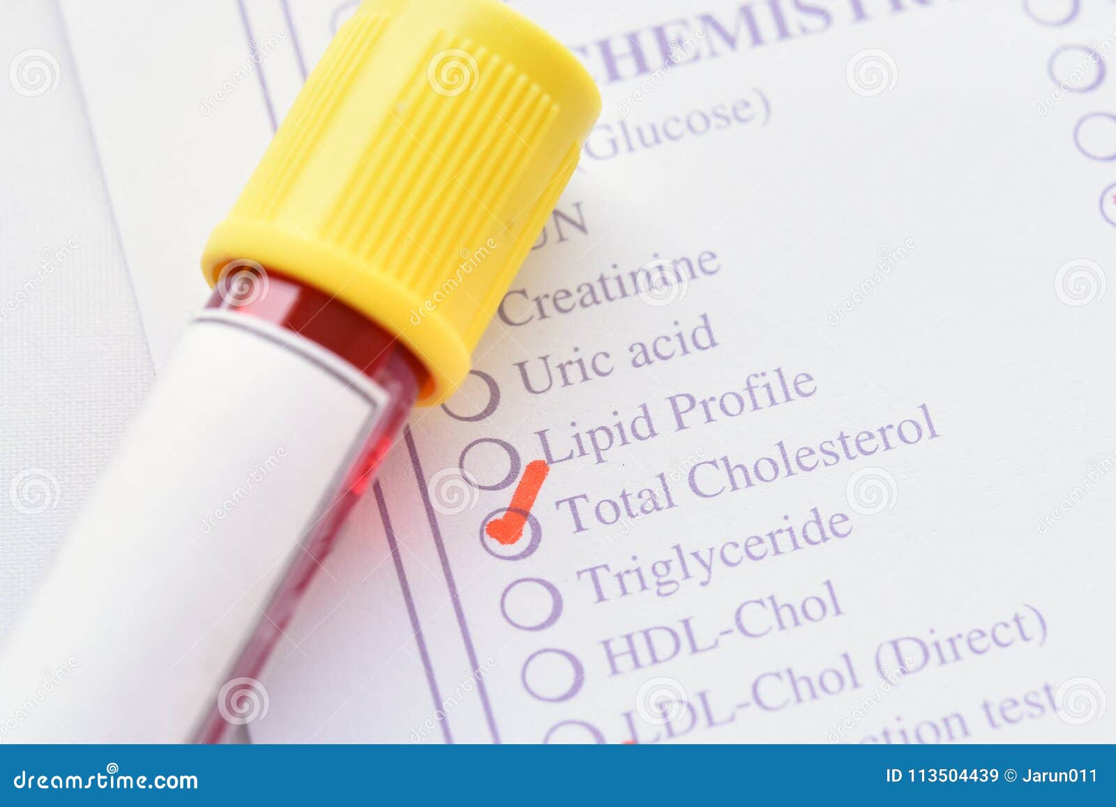 Blood for cholesterol test stock image. Image of attack 113504439