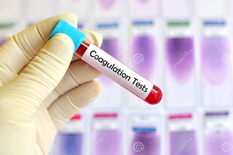 Blood for coagulation test stock photo. Image of experiment 111499304