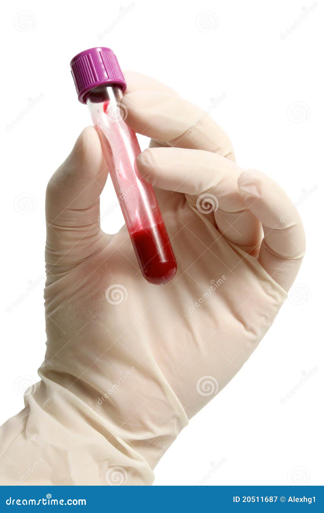 Blood Container in Hand with Glove Stock Image Image of isolated