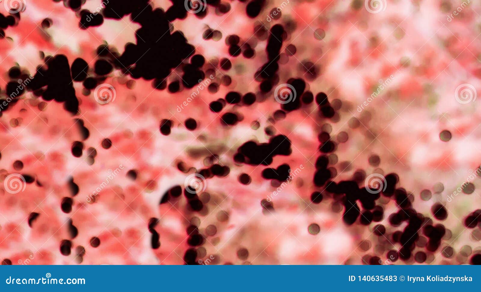 Как рассмотреть кровь под микроскопом Blood Corpuscles a Microscope, Blood Type View Macro - Image. Blood Stock Image 