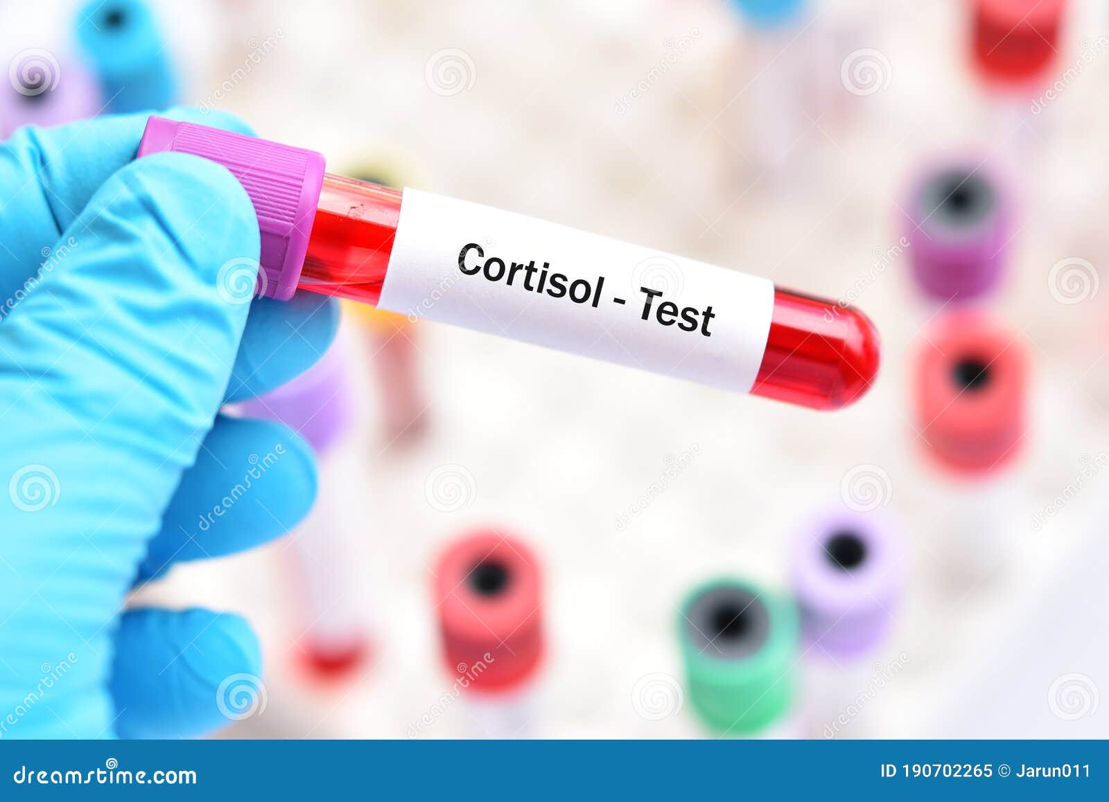 Blood for Cortisol Hormone Test Stock Image Image of analyzing