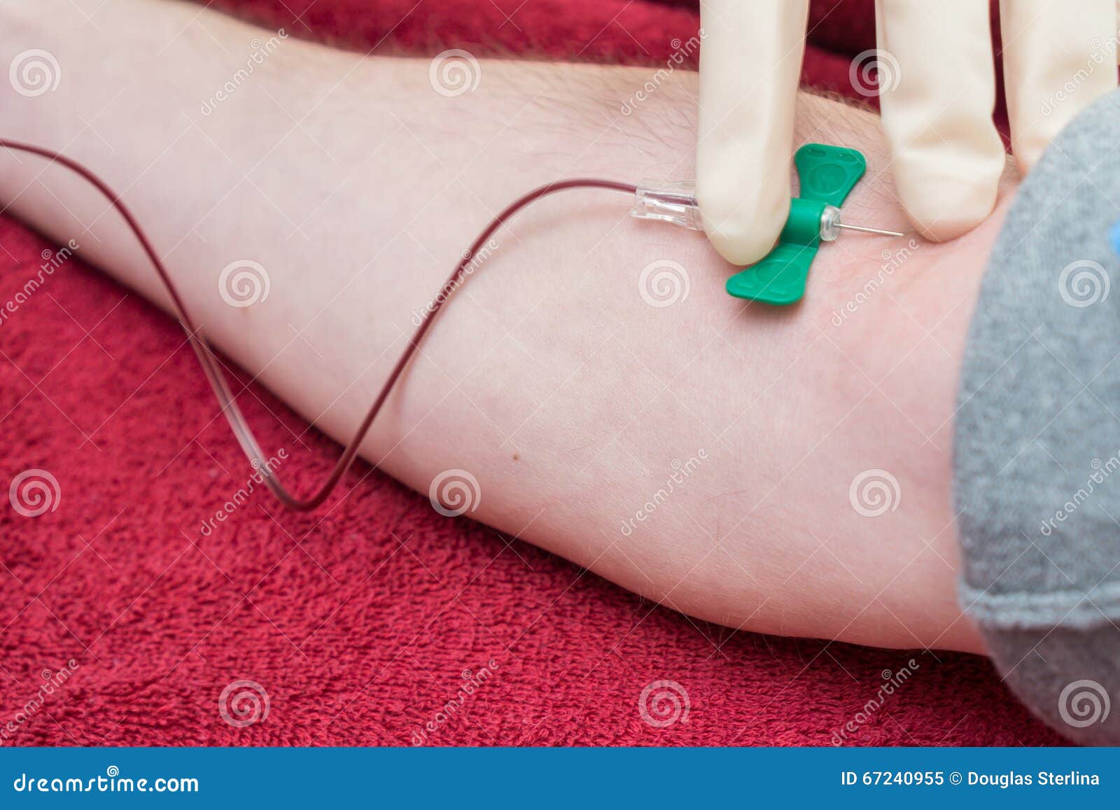 Blood Draw stock image. Image of sample, type, blood 67240955