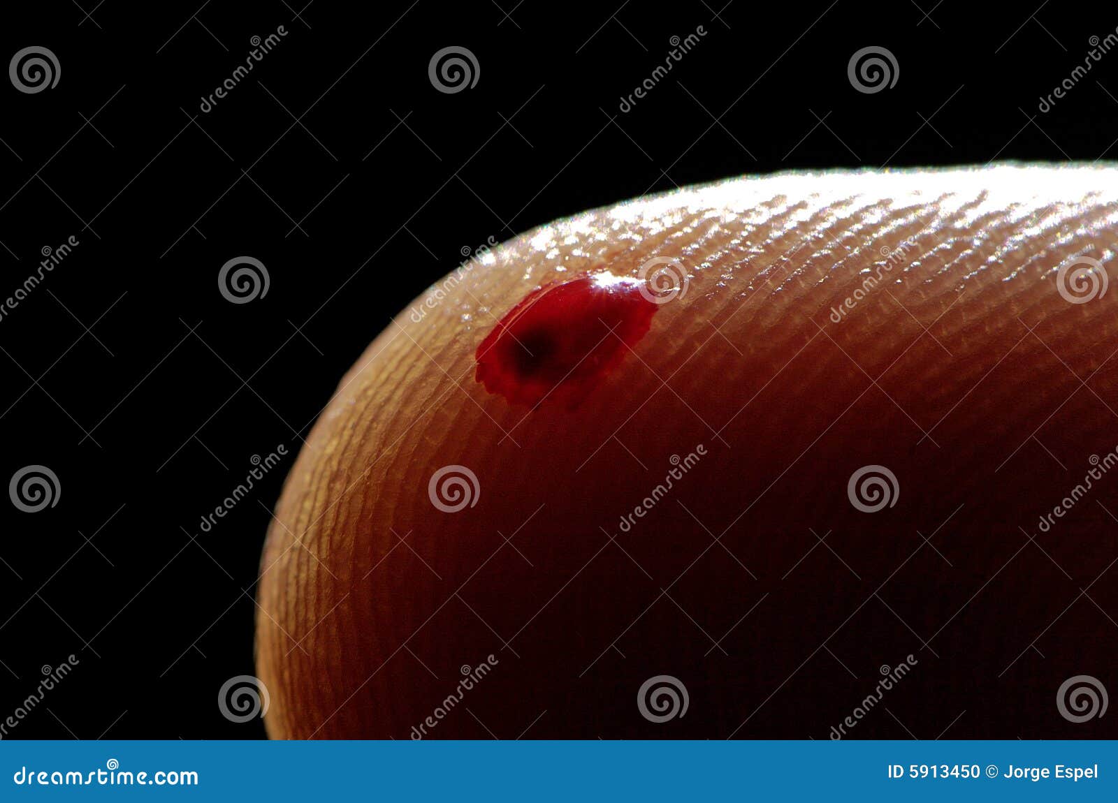 Blood Droplet On Finger Stock Photo Image 5913450