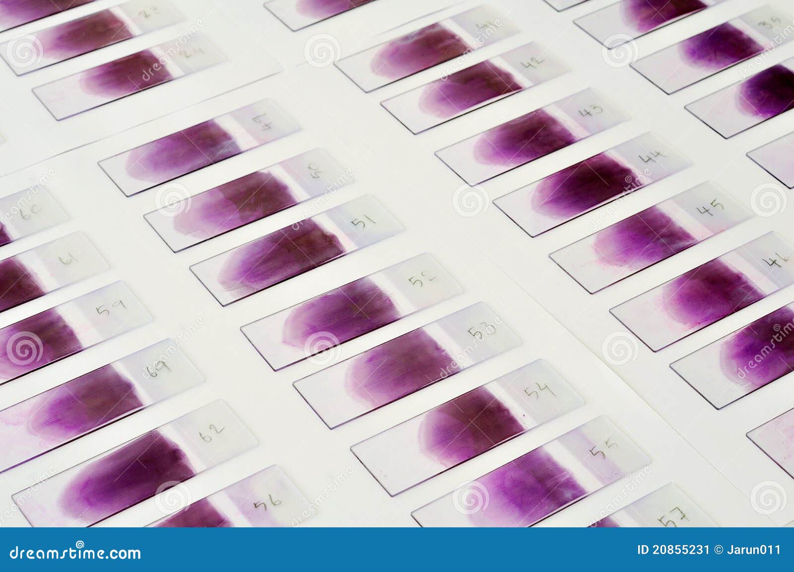 test blood 4 of stain, laboratory, stock Blood film image. Image test test blood 4 of stain, laboratory, stock Blood film image. Image test