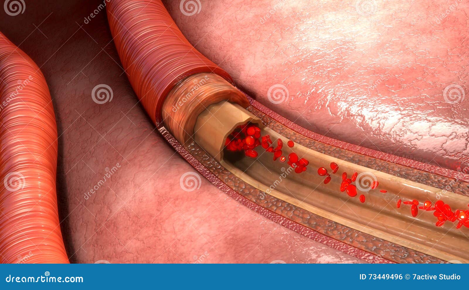 blood flow in vessels